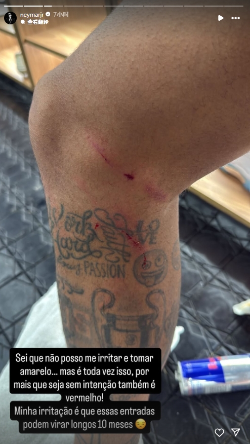 华体会hth体育官网入口-伤痕累累！刚复出的内马尔晒腿部划痕：每次都可能发生